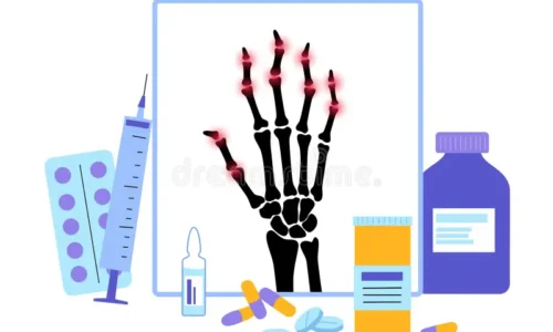 Rheumatology